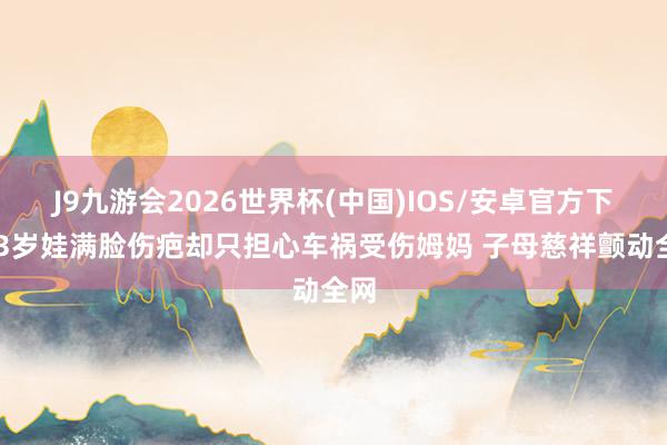 J9九游会2026世界杯(中国)IOS/安卓官方下载 3岁娃满脸伤疤却只担心车祸受伤姆妈 子母慈祥颤动全网
