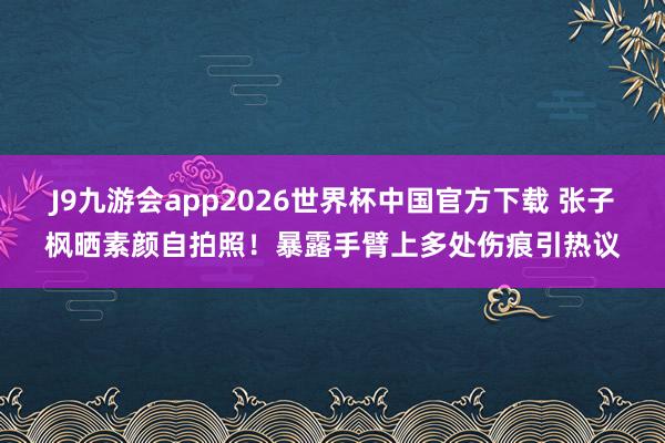 J9九游会app2026世界杯中国官方下载 张子枫晒素颜自拍照！暴露手臂上多处伤痕引热议